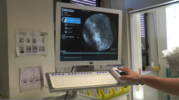 Le Quotidien du Médecin: Un Microscope à l’intérieur des patients