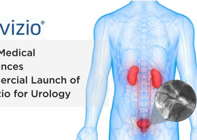 Mauna Kea Technologies annonce le lancement mondial par Cook Medical du Cellvizio en Urologie