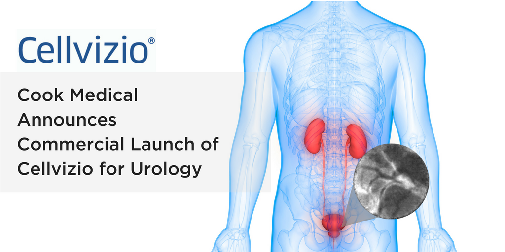 Cook Medical Announces Commercial Launch of Cellvizio for Urology