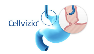 Publication dans Surgical Endoscopy des résultats positifs d’un essai clinique multicentrique prospectif américain sur la détection de l’œsophage de Barrett avec Cellvizio®