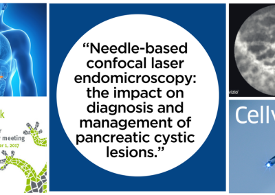 Nouvelle analyse de l’étude contact démontre l’impact positif du Cellvizio sur la prise en charge des patients avec une lésion kystique du pancréas