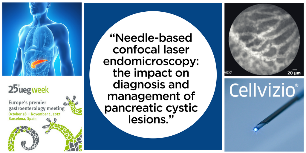 New Contact Study Analysis Demonstrates Cellvizio’s Ability to Improve The Management of Patients with Pancreatic Cysts