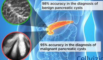 Publication d’une nouvelle étude validant l’efficacité incomparable du Cellvizio et la concordance inter-observateur pour la caractérisation des kystes pancréatiques
