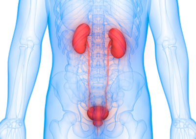 Mauna Kea Technologies Fait Le Point Sur Son Partenariat Commercial Pour Les Applications Urologiques